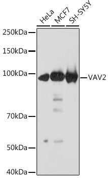 VAV2 Rabbit mAb