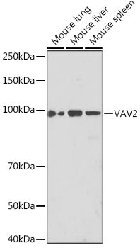 VAV2 Rabbit mAb