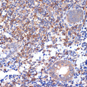 VAV2 Rabbit mAb