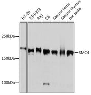 SMC4 Rabbit mAb