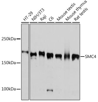 SMC4 Rabbit mAb
