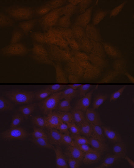 SMC4 Rabbit mAb