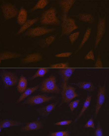 SMC4 Rabbit mAb