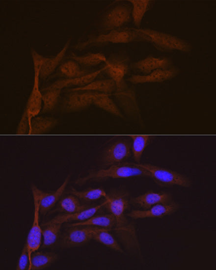 SMC4 Rabbit mAb