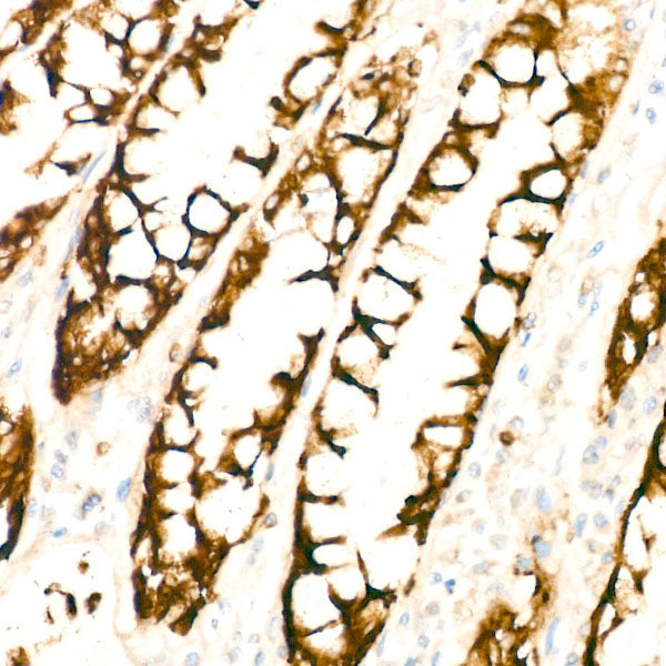 COX2/PTGS2 Rabbit mAb