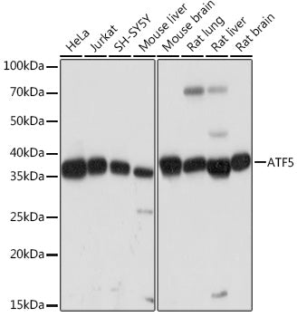 ATF5 Rabbit mAb
