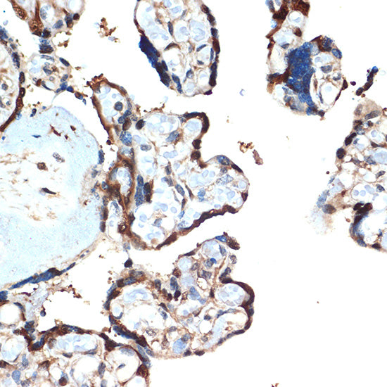 ATF5 Rabbit mAb
