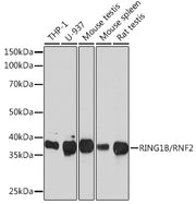 RING1B/RNF2 Rabbit mAb