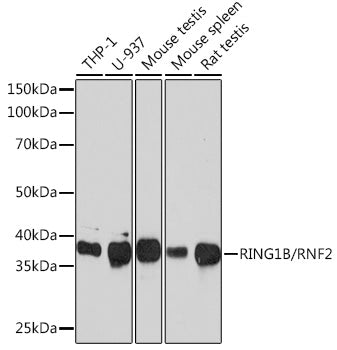 RING1B/RNF2 Rabbit mAb