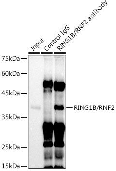 RING1B/RNF2 Rabbit mAb