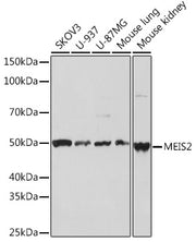 MEIS2 Rabbit mAb