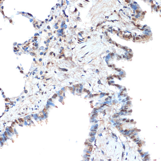 CoREST/RCOR1 Rabbit mAb