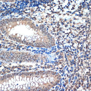 CoREST/RCOR1 Rabbit mAb