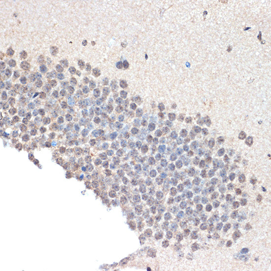 CoREST/RCOR1 Rabbit mAb