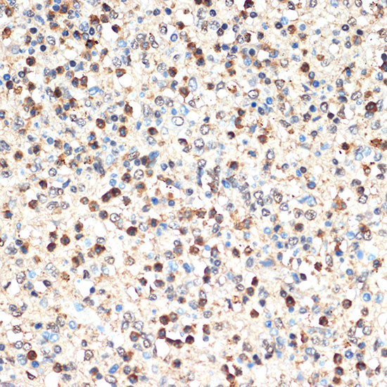 SHIP1 Rabbit mAb