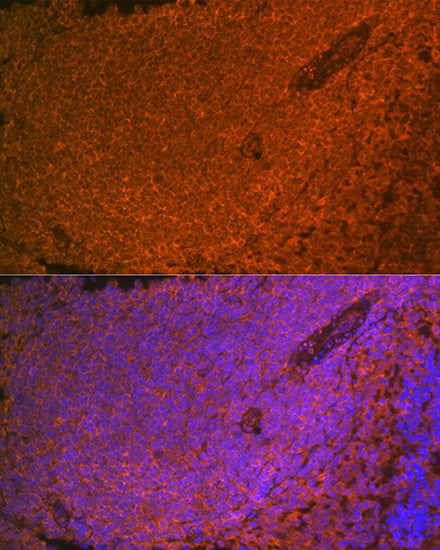 SHIP1 Rabbit mAb