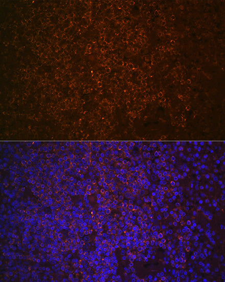 SHIP1 Rabbit mAb