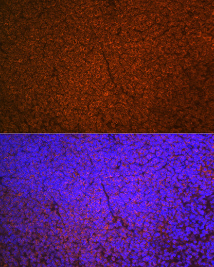 SHIP1 Rabbit mAb