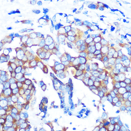 HDAC6 Rabbit mAb