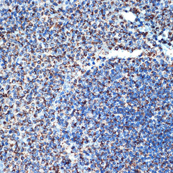 DCR2 Rabbit mAb