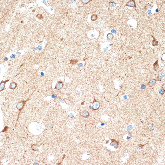 DCR2 Rabbit mAb