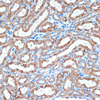 DCR2 Rabbit mAb