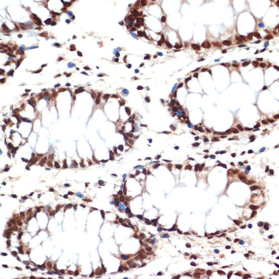 CDC16 Rabbit mAb