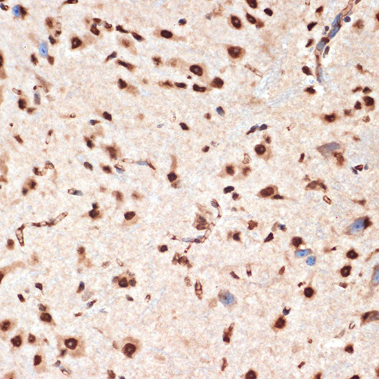 CDC16 Rabbit mAb