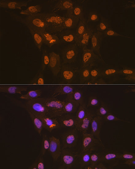 CDC16 Rabbit mAb