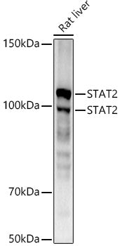 [KD Validated] STAT2 Rabbit mAb