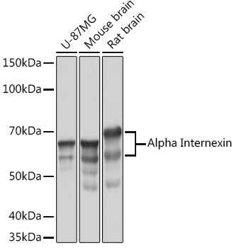 Alpha Internexin Rabbit mAb