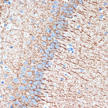 Alpha Internexin Rabbit mAb