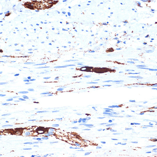 Alpha Internexin Rabbit mAb