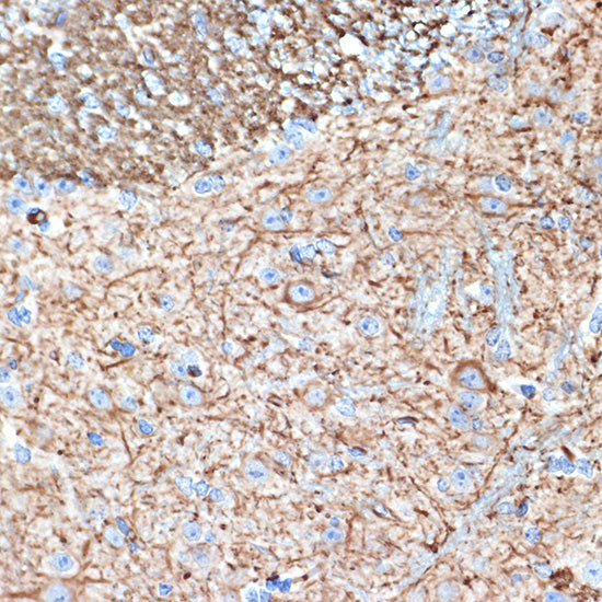 Alpha Internexin Rabbit mAb