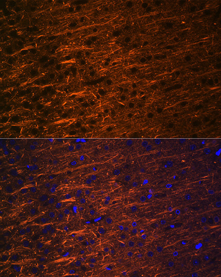 Alpha Internexin Rabbit mAb