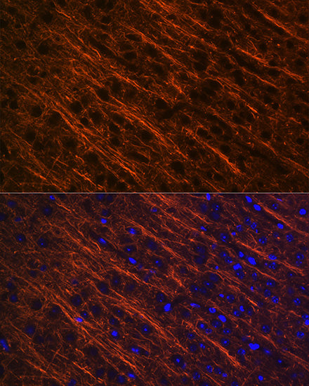 Alpha Internexin Rabbit mAb