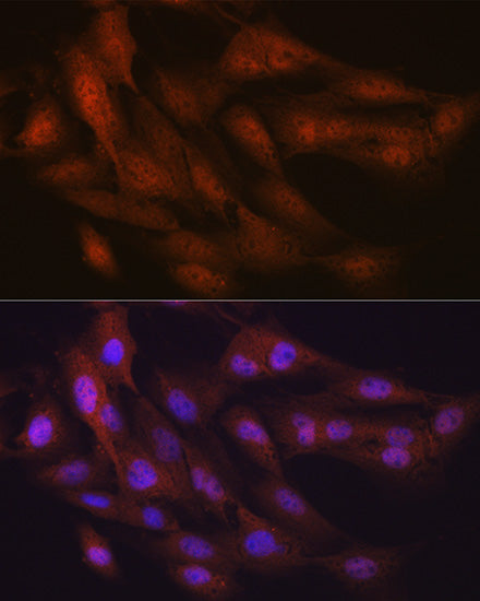 K48-linkage Specific Ubiquitin Rabbit mAb