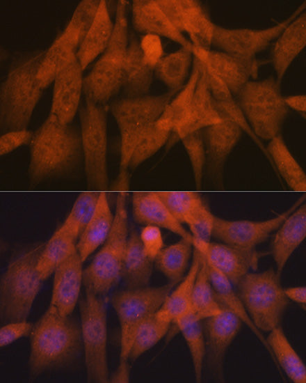 K48-linkage Specific Ubiquitin Rabbit mAb