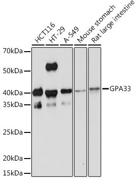 GPA33 Rabbit mAb