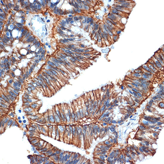 GPA33 Rabbit mAb