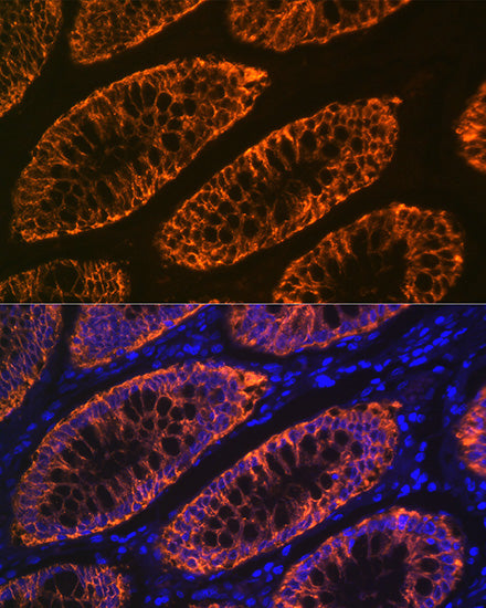 GPA33 Rabbit mAb
