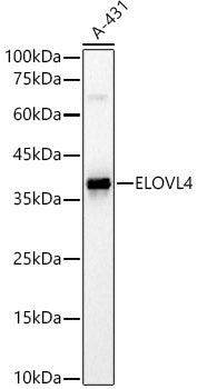 ELOVL4 Rabbit pAb