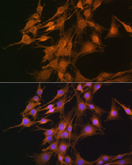 ELOVL4 Rabbit pAb