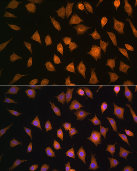 ELOVL4 Rabbit pAb