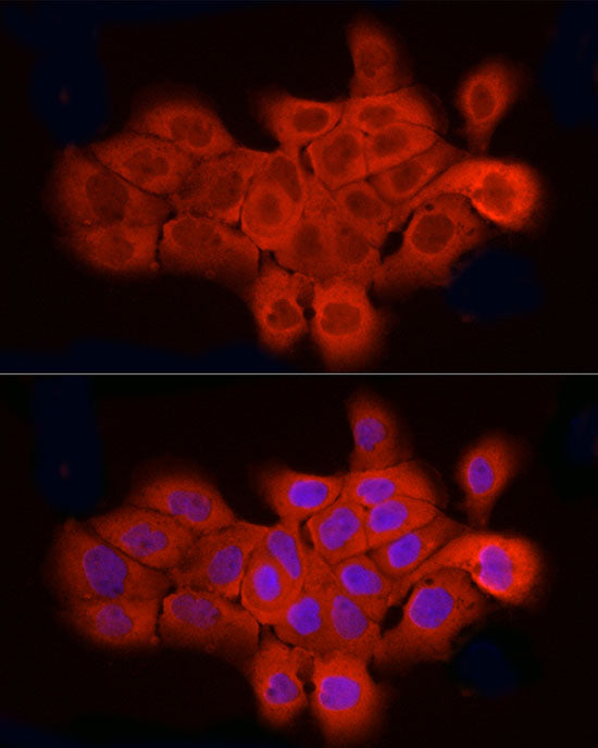 ELOVL4 Rabbit pAb