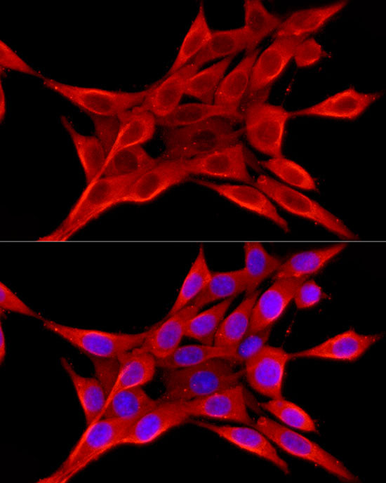 ELOVL4 Rabbit pAb
