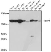 RBBP4 Rabbit mAb