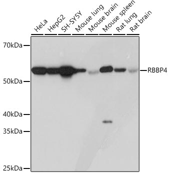 RBBP4 Rabbit mAb
