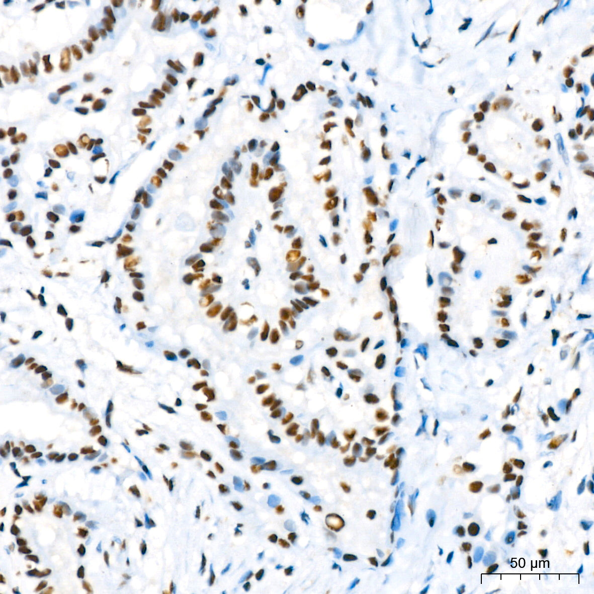 RBBP4 Rabbit mAb