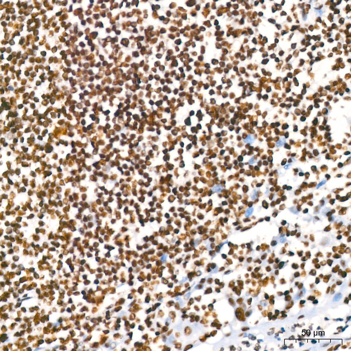 RBBP4 Rabbit mAb